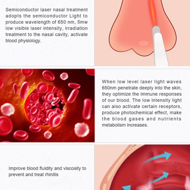 RHINITIS AID MULTI-FUNCTIONAL NOSE TREATMENT OF RHINITIS & SINUSITIS | LV005 |
